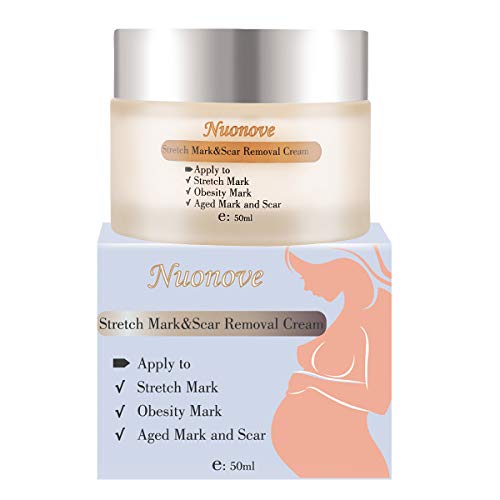 Stretch Marks Cream, Dehnungsstreifen Creme, Dehnungsstreifen Entfernen, Narbencreme Entfernung...