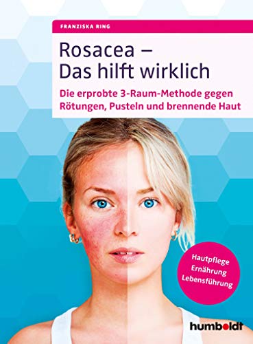 Rosacea - Das hilft wirklich: Die erprobte 3-Raum-Methode gegen Rötungen, Pusteln und brennende...