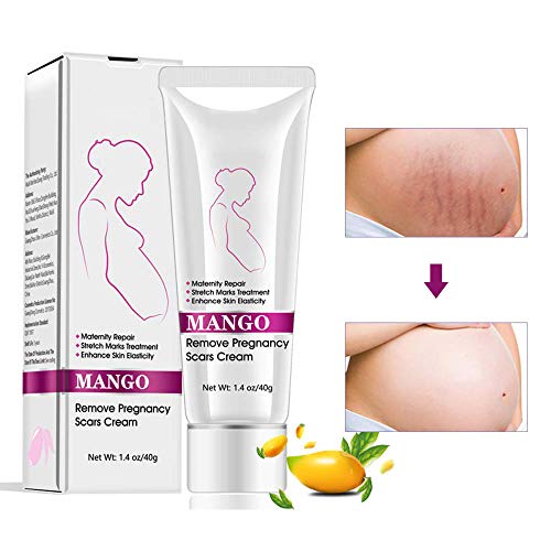 Stretch Marks Cream Narbencreme, Narbencreme Entfernung Creme, Körper Reparatur Creme...