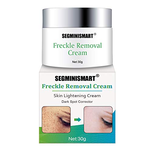 Whitening Cream,Aufhellende Creme, Altersflecken Creme,Flecken Creme pigmentflecken entferner,Haut...