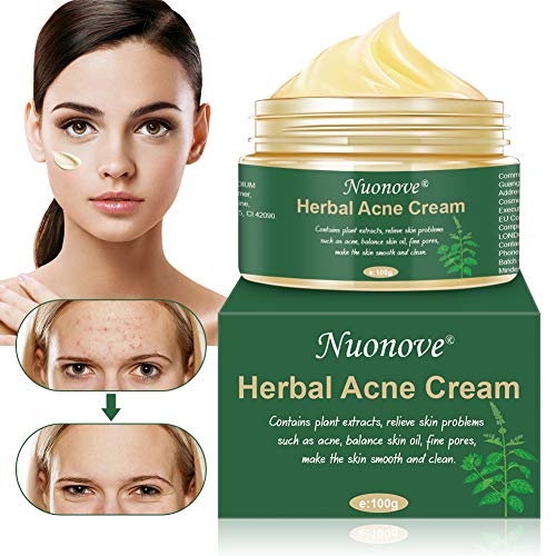 Akne Creme, Anti Pickel Creme, Akne Entferner Creme, Akne Narben Creme, Anti Akne Creme, Balance...