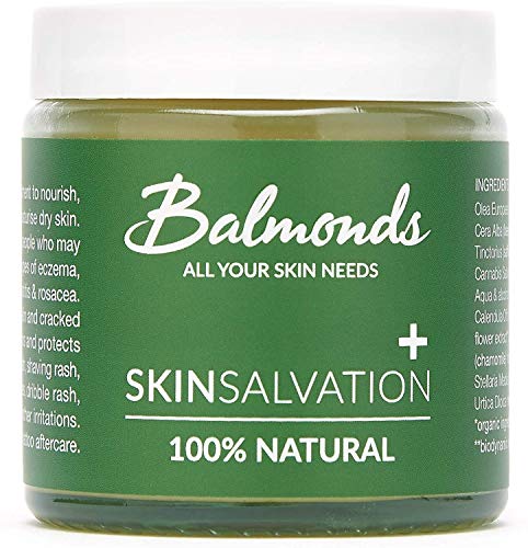 Ekzem Creme - Balmonds Skin Salvation 120ml -100% natürliche - Psoriasis Salbe für Babys, Kinder,...