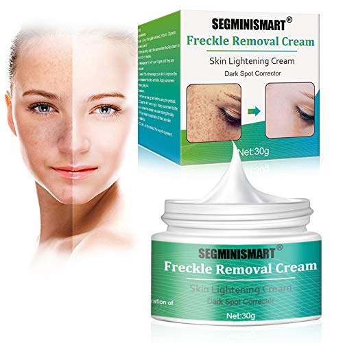 Whitening Cream,Aufhellende Creme,Sommersprossen Creme,Altersflecken Creme,Haut Aufhellende Creme...