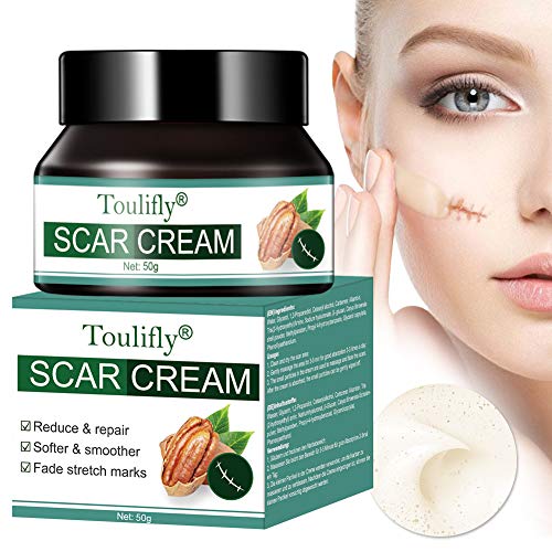 Narbencreme, Narbensalbe, Dehnungsstreifen Creme, Narbencreme Gesicht, Scar Cream, Akne Creme,...