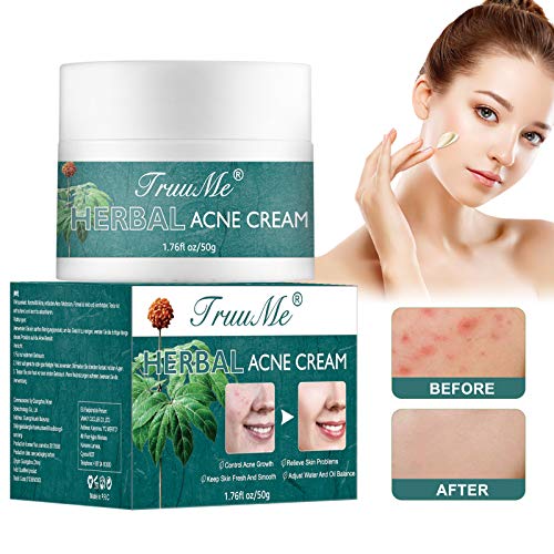 Akne Creme, Acne Treatment Cream, Akne Entferner Creme, Hilft Gesicht Akne zu Entfernen,...