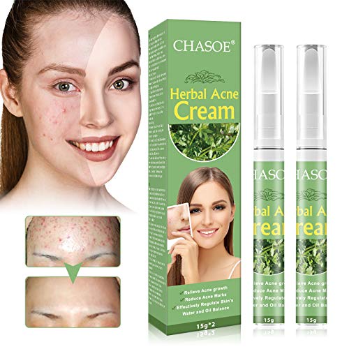 Acne Treatment, Akne Creme, Anti Pickel Creme, Gegen Pickel und unreine Haut für ein klareres...